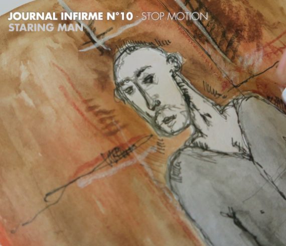 Journal infirme 0010 : Staring Man